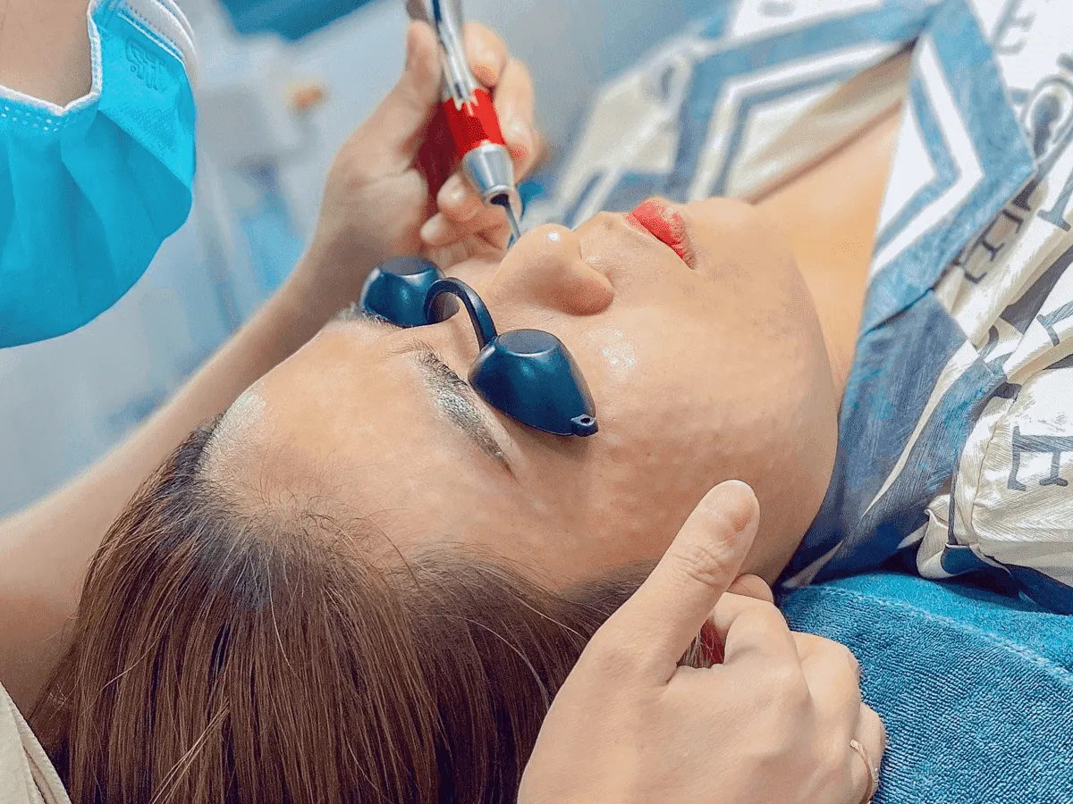 Laser Hỗ Trợ Giảm Giãn Mạch