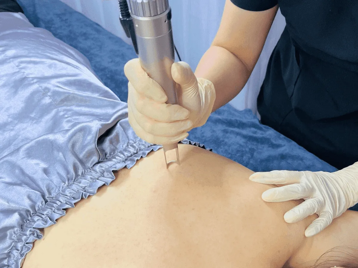 Laser Toning Vùng Lưng