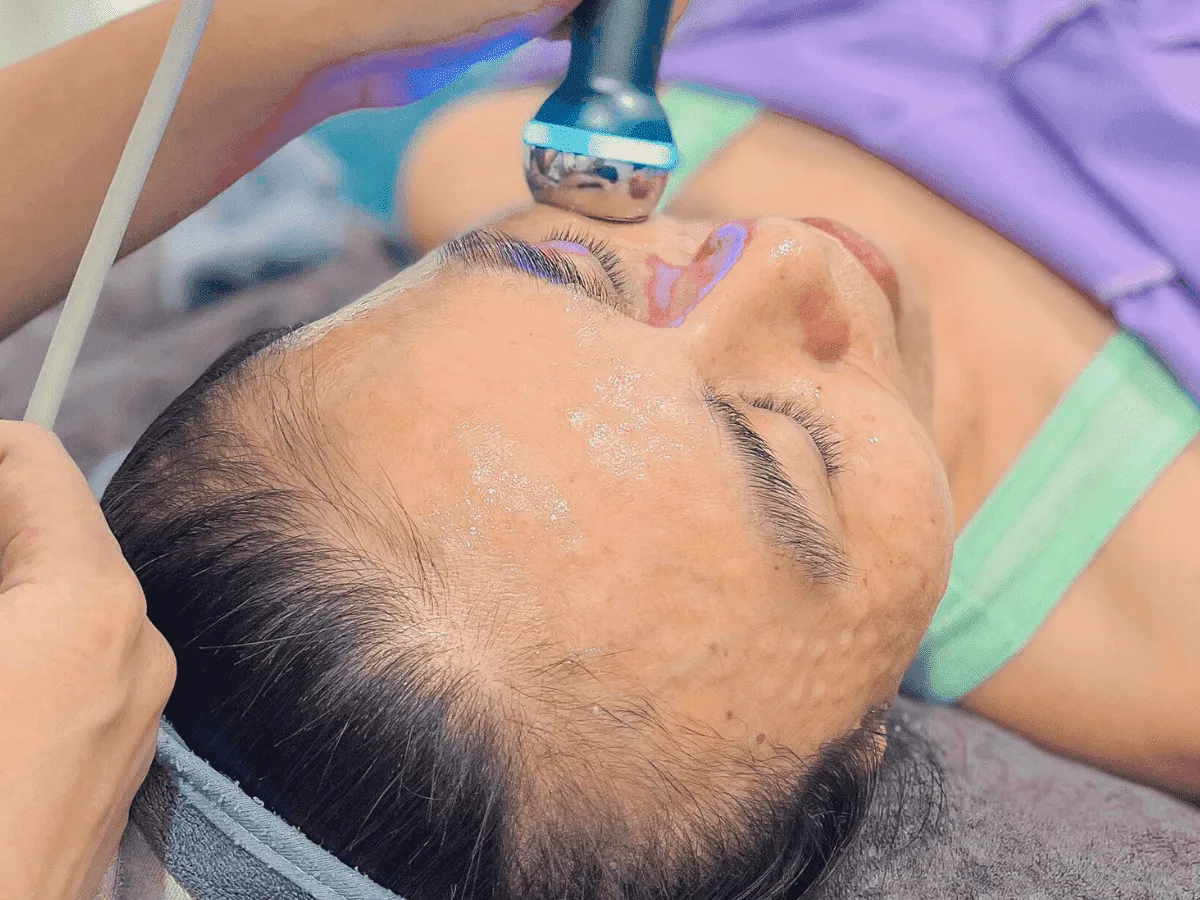 Meso Cấp Ẩm Căng Bóng