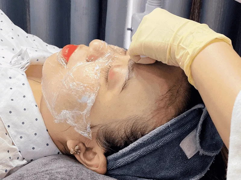 Meso Sáng Da Giảm Thâm