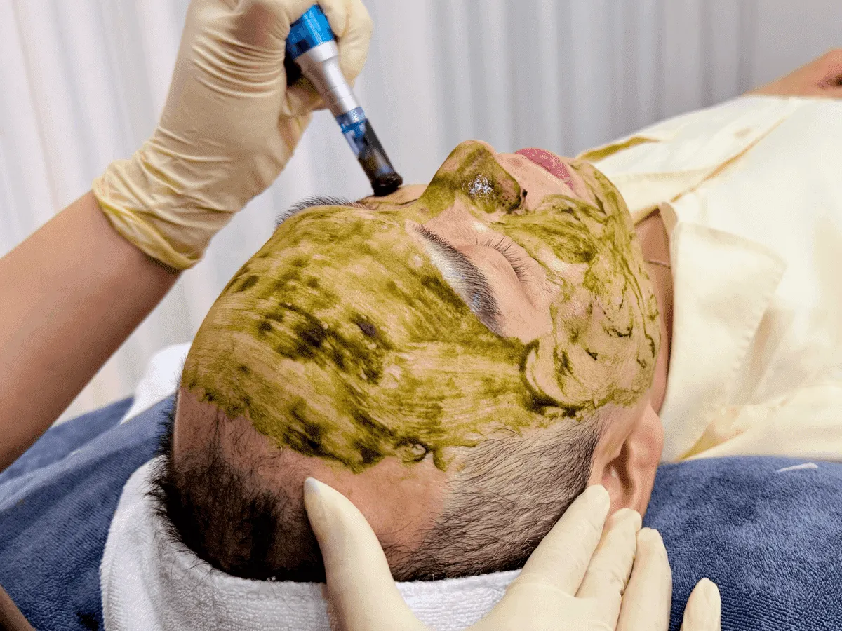 Nano Mầm Sinh Học Mờ Thâm